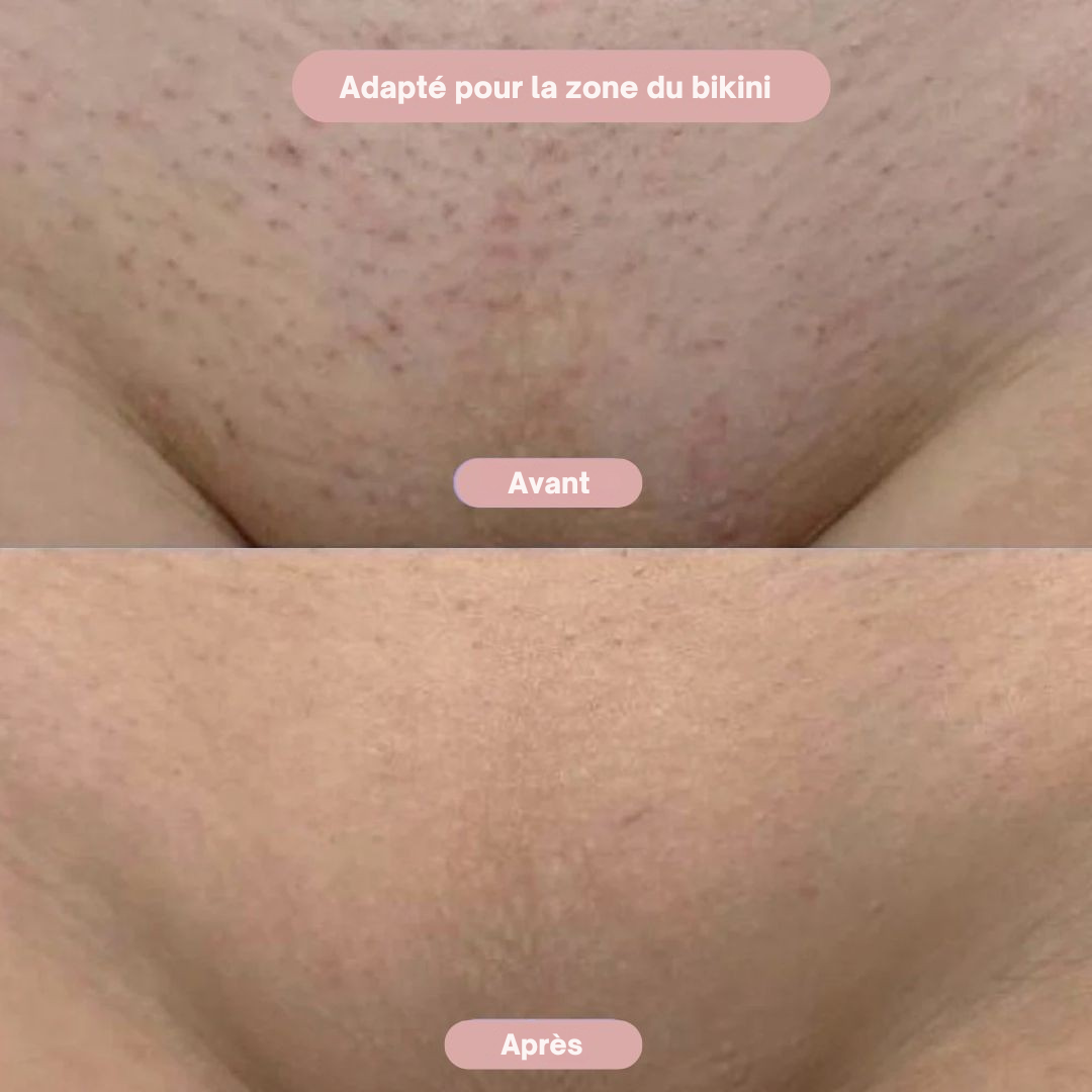 GlamGlide : Rasoir Corporel 2-en-1 pour Femmes