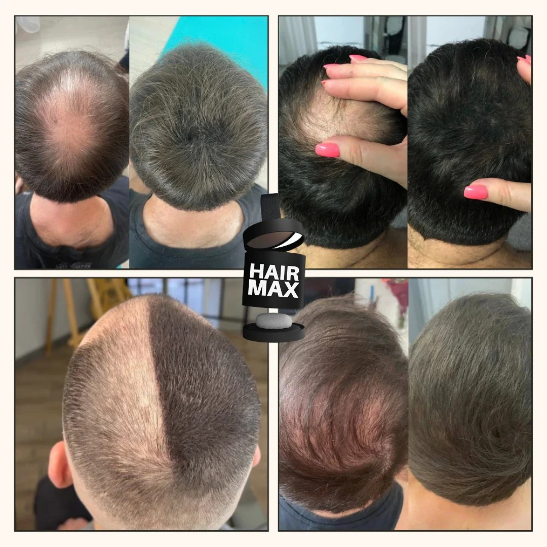 Haar-Camouflage